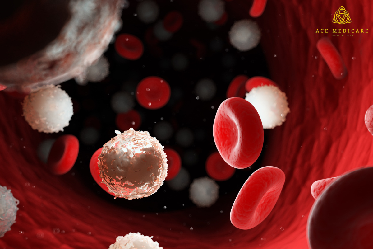 Conquering Blood Cancer: Promising Advances in Research and Treatment
